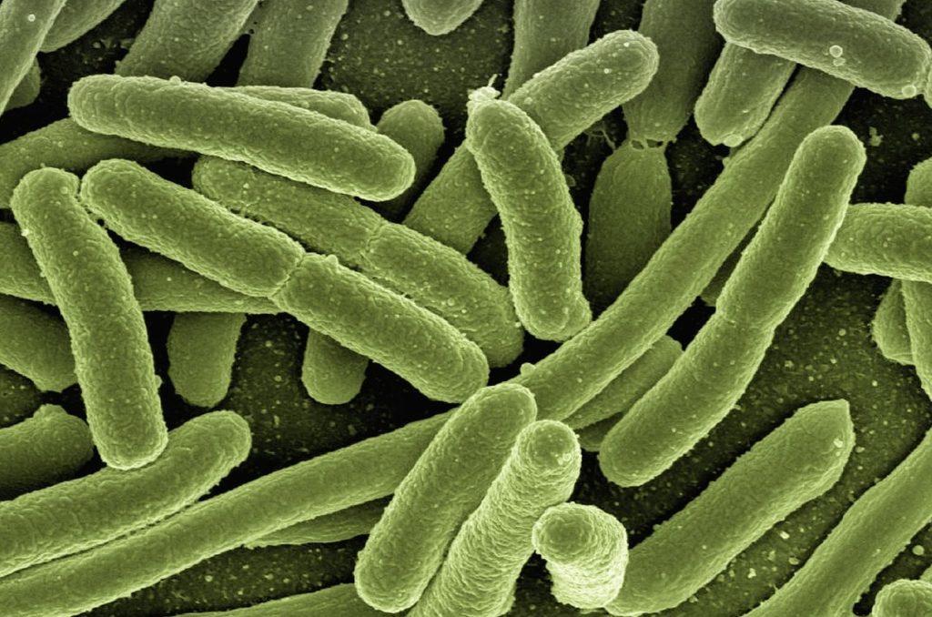 koli bacteria, escherichia coli, bacteria, disease, pathogens, microscopy, electron microscopy, electron microscope, vaccination, immune system, diseases, vaccine, escherichia, infect, infection, risk of infection, pathogen, viruses, bacteria, bacteria, bacteria, bacteria, bacteria